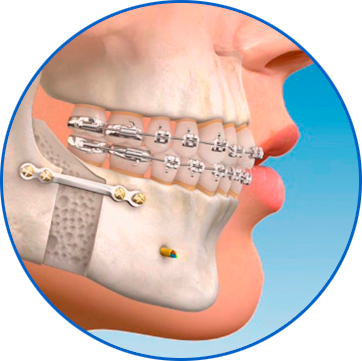 cirugía maxilofacial en santiago de chile