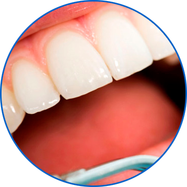 periodoncia