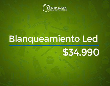 Blanqueamiento