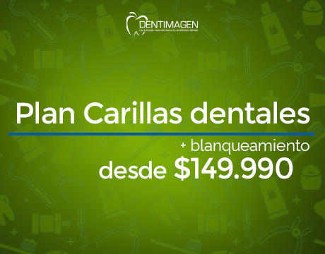 Carillas
