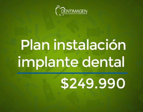 Implante