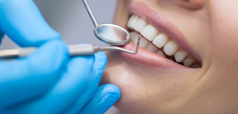 eliminar el sarro de los dientes