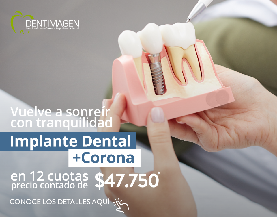 Promociones marzo-03